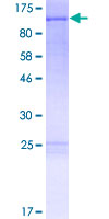 ab165954 on a 12.5% SDS-PAGE stained with Coomassie Blue.