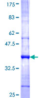 ab162081 on a 12.5% SDS-PAGE stained with Coomassie Blue.