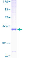 ab161977 on a 12.5% SDS-PAGE stained with Coomassie Blue.
