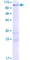 ab162749 on a 12.5% SDS-PAGE stained with Coomassie Blue.