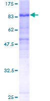 ab165979 on a 12.5% SDS-PAGE stained with Coomassie Blue.