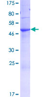 ab163710 on a 12.5% SDS-PAGE stained with Coomassie Blue.