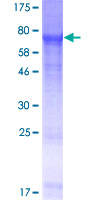 ab163140 on a 12.5% SDS-PAGE stained with Coomassie Blue.