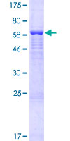 ab165814 on a 12.5% SDS-PAGE stained with Coomassie Blue.