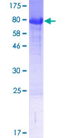 ab163224 on a 12.5% SDS-PAGE stained with Coomassie Blue.