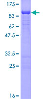 ab160640 on a 12.5% SDS-PAGE stained with Coomassie Blue.
