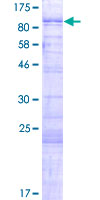 ab165668 on a 12.5% SDS-PAGE stained with Coomassie Blue.