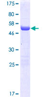 ab166224 on a 12.5% SDS-PAGE stained with Coomassie Blue.