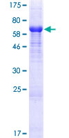 ab166188 on a 12.5% SDS-PAGE stained with Coomassie Blue.