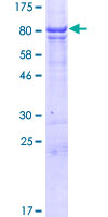 ab163000 on a 12.5% SDS-PAGE stained with Coomassie Blue.
