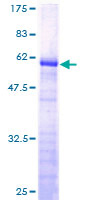 ab165626 on a 12.5% SDS-PAGE stained with Coomassie Blue.