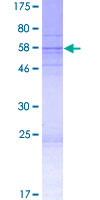ab166260 on a 12.5% SDS-PAGE stained with Coomassie Blue.