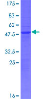 ab164519 on a 12.5% SDS-PAGE stained with Coomassie Blue.