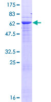 ab166146 on a 12.5% SDS-PAGE stained with Coomassie Blue.