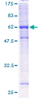 ab162967 on a 12.5% SDS-PAGE stained with Coomassie Blue.