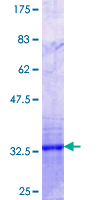 ab160849 on a 12.5% SDS-PAGE stained with Coomassie Blue.