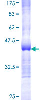 ab158420 on a 12.5% SDS-PAGE stained with Coomassie Blue.