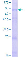 ab162309 on a 12.5% SDS-PAGE stained with Coomassie Blue.