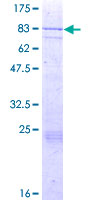 ab161201 on a 12.5% SDS-PAGE stained with Coomassie Blue.