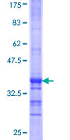 ab161202 on a 12.5% SDS-PAGE stained with Coomassie Blue.