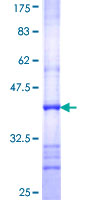 ab164071 on a 12.5% SDS-PAGE stained with Coomassie Blue.