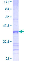ab161234 on a 12.5% SDS-PAGE stained with Coomassie Blue.