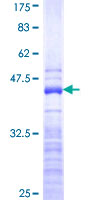 ab158421 on a 12.5% SDS-PAGE stained with Coomassie Blue.