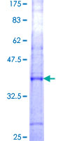 ab165069 on a 12.5% SDS-PAGE stained with Coomassie Blue.