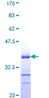 ab162831 on a 12.5% SDS-PAGE stained with Coomassie Blue.