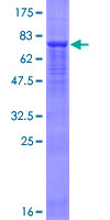 ab161954 on a 12.5% SDS-PAGE stained with Coomassie Blue.