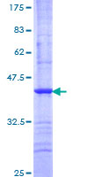 ab161955 on a 12.5% SDS-PAGE stained with Coomassie Blue.