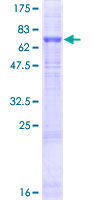 ab165886 on a 12.5% SDS-PAGE stained with Coomassie Blue.
