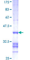 ab166564 on a 12.5% SDS-PAGE stained with Coomassie Blue.