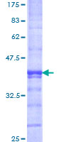 ab161493 on a 12.5% SDS-PAGE stained with Coomassie Blue.