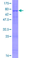 ab165534 on a 12.5% SDS-PAGE stained with Coomassie Blue.