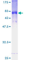ab161801 on a 12.5% SDS-PAGE stained with Coomassie Blue.