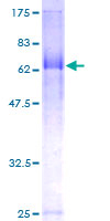 ab164715 on a 12.5% SDS-PAGE stained with Coomassie Blue.