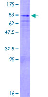 ab161929 on a 12.5% SDS-PAGE stained with Coomassie Blue.