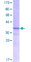 ab161930 on a 12.5% SDS-PAGE stained with Coomassie Blue.