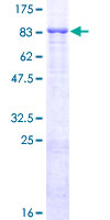 ab161939 on a 12.5% SDS-PAGE stained with Coomassie Blue.