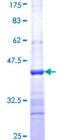ab161940 on a 12.5% SDS-PAGE stained with Coomassie Blue.