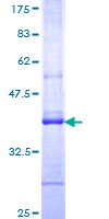 ab161938 on a 12.5% SDS-PAGE stained with Coomassie Blue.
