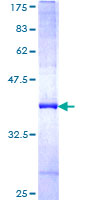 ab161567 on a 12.5% SDS-PAGE stained with Coomassie Blue.