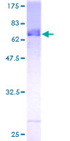 ab163070 on a 12.5% SDS-PAGE stained with Coomassie Blue.