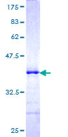 ab153522 on a 12.5% SDS-PAGE stained with Coomassie Blue.