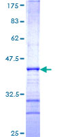 ab165690 on a 12.5% SDS-PAGE stained with Coomassie Blue.