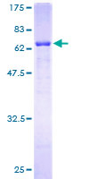 ab161936 on a 12.5% SDS-PAGE stained with Coomassie Blue.