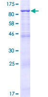 ab161501 on a 12.5% SDS-PAGE stained with Coomassie Blue.