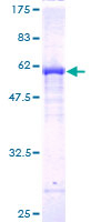 ab161951 on a 12.5% SDS-PAGE stained with Coomassie Blue.