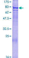 ab161948 on a 12.5% SDS-PAGE stained with Coomassie Blue.